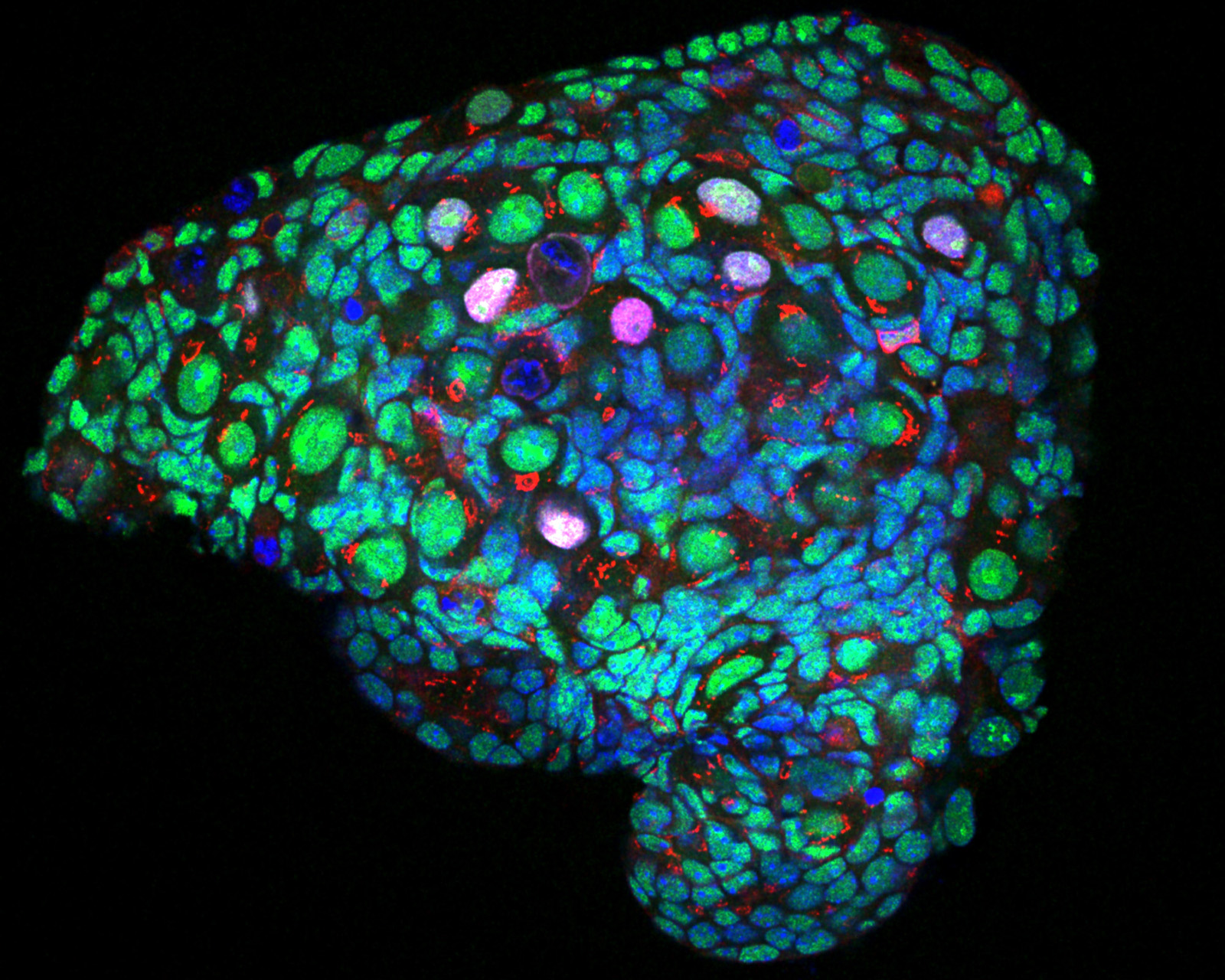 Immuno-stained mouse ovary, part of a study on the effects of chemotherapy on oocytes, cells that have the potential to form an ovum. Image taken with a LeicaSP8 confocal microscope by Edgar Diaz-Miranda from Lei Lei’s laboratory, Department of Obstetrics, Gynecology and Women’s Health, School of Medicine.